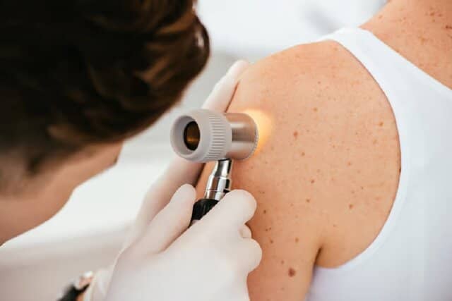 نصف شدن خطر مرگ ناشی از سرطان پوست با فناوری mRNA
